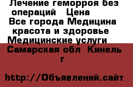 Лечение геморроя без операций › Цена ­ 300 - Все города Медицина, красота и здоровье » Медицинские услуги   . Самарская обл.,Кинель г.